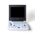 Machine à échographie de l&#39;ordinateur portable MaineCat pour les cliniques
